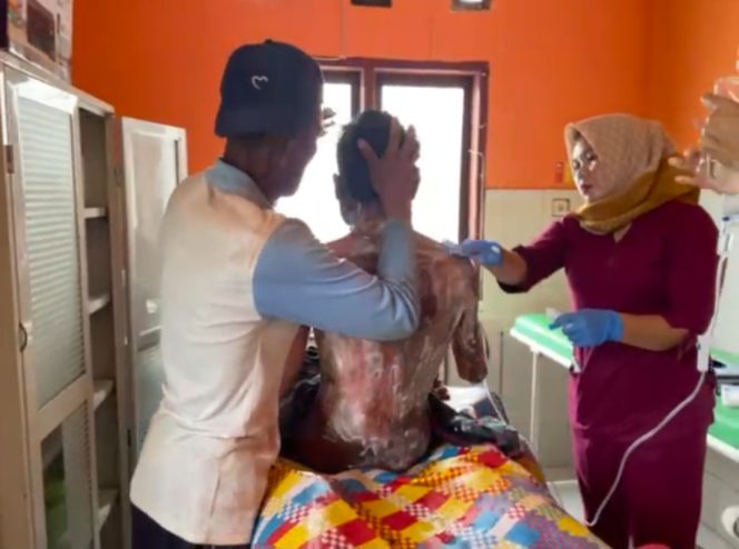 
 Insiden Tragis di Sumbawa, Anak Dibakar Ibu Kandung akibat Perselisihan